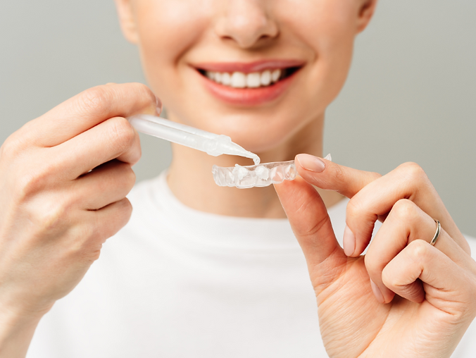 Wybielanie nakładkowe