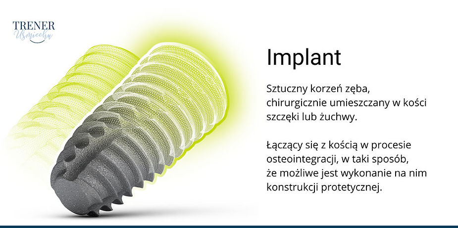 co to jest implant zęba