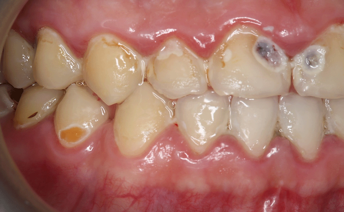 pacjent z nadwrażliwością w gabinecie