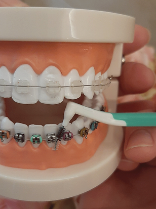 pielęgnacja aparatów ortodontycznych